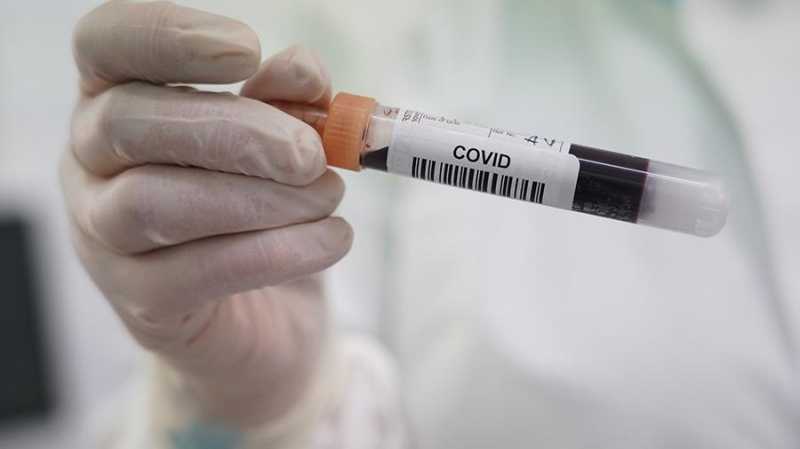 Ученые предлагают из антител лошадей сделать дешевое лекарство от COVID-19