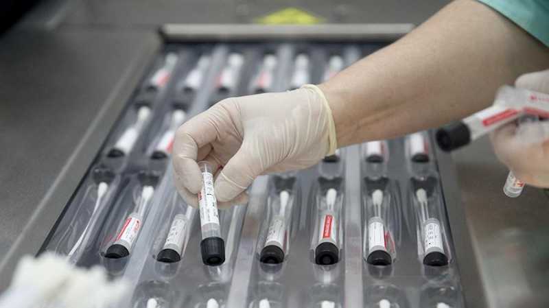 Эпидемиолог объяснил ошибочность тестов на коронавирус