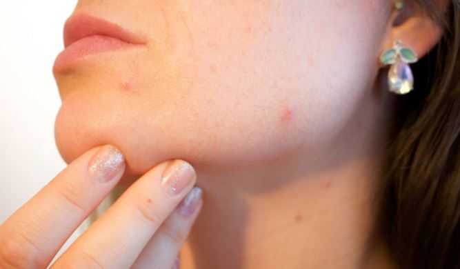 Безобидные изменения на коже могут указывать на развитие рака
